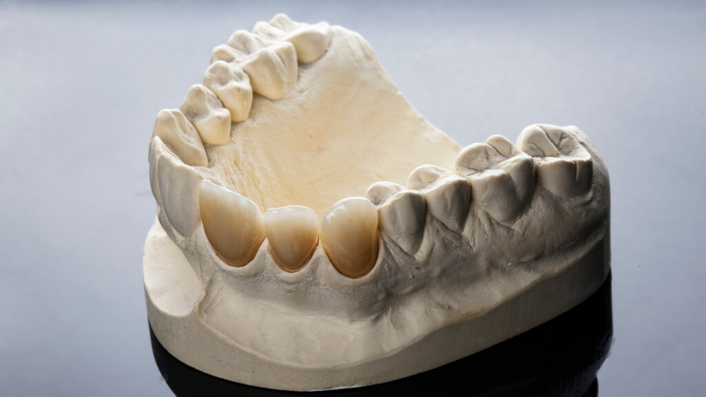 歯のない歯の模型
